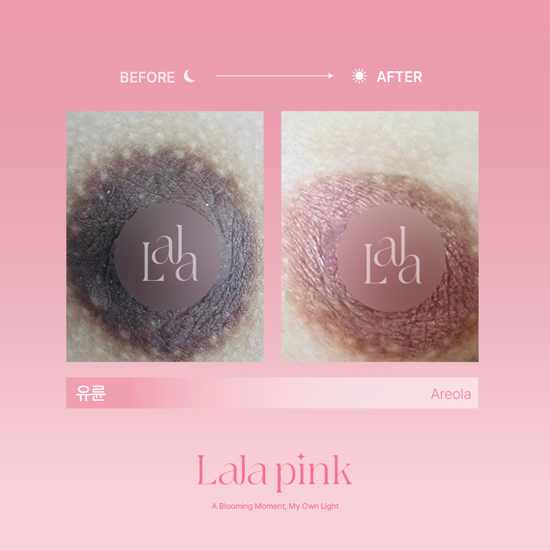 Before / After 症例 09
